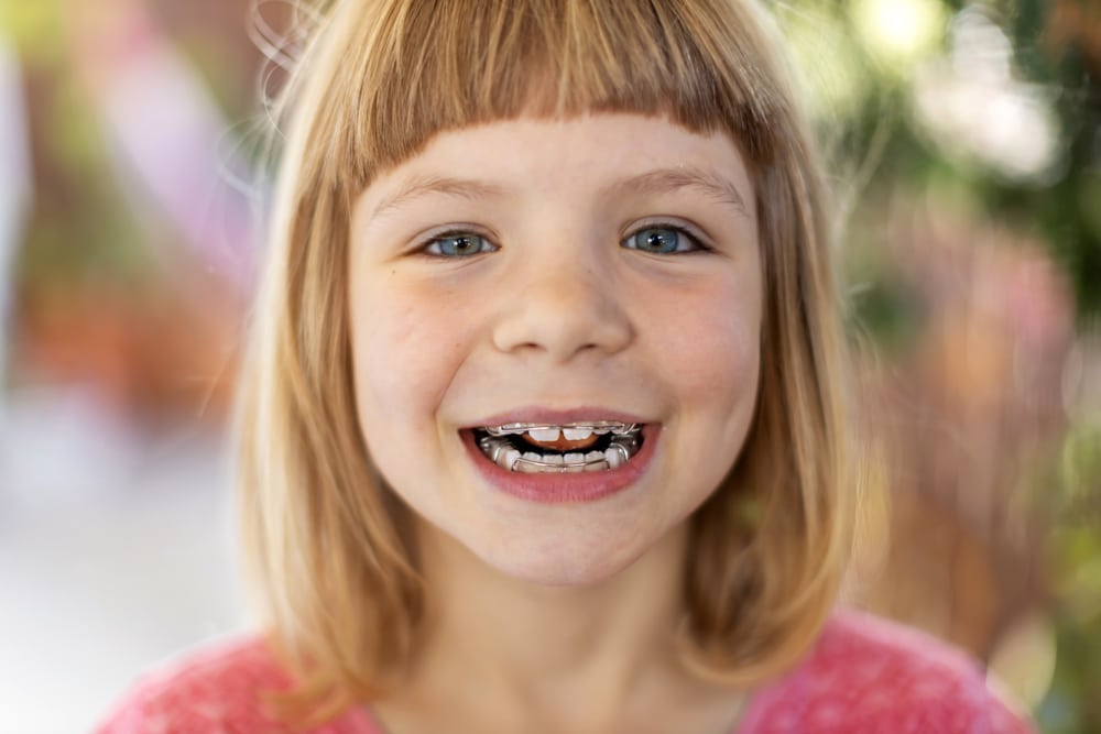 Wow Orthodontics, Invisalign, Clear Braces, Meta Braces, Clear Aligners, Retainers, Mouth Guards, Traditional Braces, Invisalign Provider Brentwood Tennessee 37027, Orthodontics Braces Invisalign for Teens, Orthodontics Braces Invisalign for Adults, Orthodontics Braces Invisalign for kids, Orthodontics Braces Invisalign for Children, Emergency Orthodontist Brentwood, Emergency Orthodontics, Same Day Orthodontics in Brentwood Tennessee, Dr. Wendy Oakes Wilhelm, Orthodontic Specialist, 615-376-0969, 214 Ward Circle Ste 1100 A, Brentwood, TN 37027, Orthodontist in Brentwood Tennessee