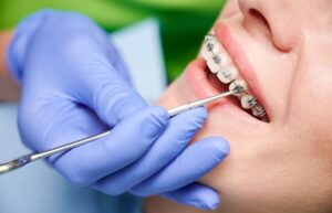 Top Orthodontist Brentwood