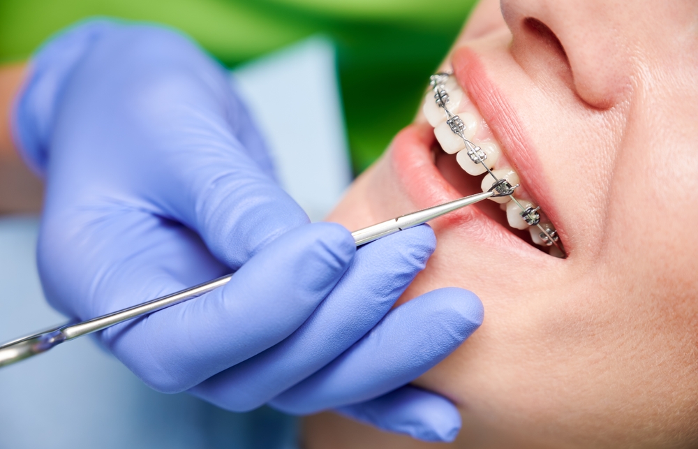 Top Orthodontist Brentwood